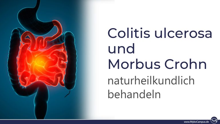Colitis ulcerosa und Morbus Crohn naturheilkundlich behandeln
