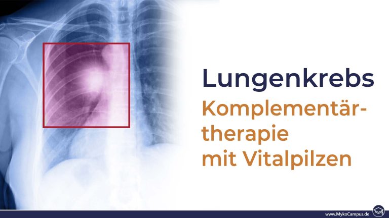 Lungenkrebs – Komplementärtherapie mit Vitalpilzen